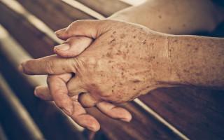 Các bệnh ngoài da thường gặp ở người cao tuổi